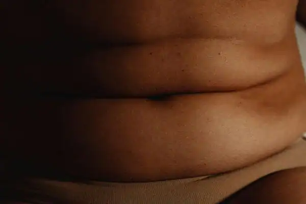 The Hidden Connection: How Stress Shapes Your Fitness and Body Composition 3 image of what stress can do on the stomach area and how Lipo 360 Farnham can help to change your body shape.