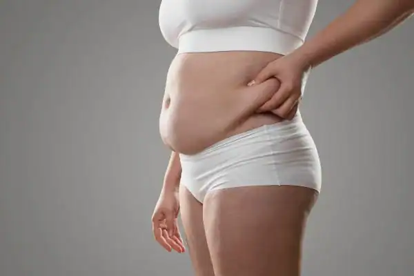 Image of stress belly Farnham How Lipo 360 can help manage your symptoms